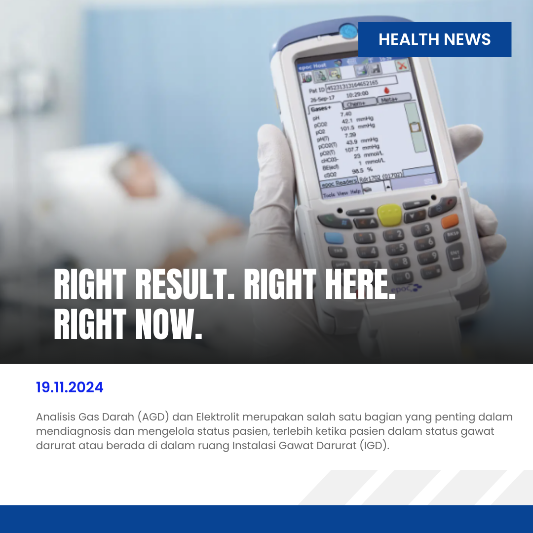 Read more about the article epoc® Blood Analysis System